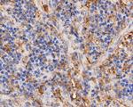 Thymidine Phosphorylase Antibody in Immunohistochemistry (Paraffin) (IHC (P))