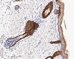 Cytokeratin 17 Antibody in Immunohistochemistry (Paraffin) (IHC (P))