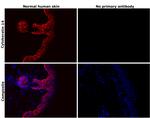 Cytokeratin 14 Antibody in Immunohistochemistry (Paraffin) (IHC (P))