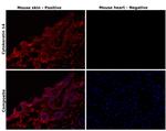 Cytokeratin 14 Antibody in Immunohistochemistry (Paraffin) (IHC (P))