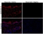 Cytokeratin 14 Antibody in Immunohistochemistry (Paraffin) (IHC (P))