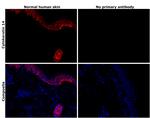 Cytokeratin 14 Antibody in Immunohistochemistry (Paraffin) (IHC (P))