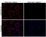 Cytokeratin 14 Antibody