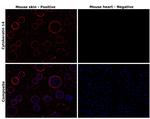 Cytokeratin 14 Antibody