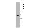 Cytokeratin 14 Antibody in Western Blot (WB)