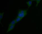 USP21 Antibody in Immunocytochemistry (ICC/IF)