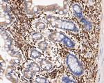 USP21 Antibody in Immunohistochemistry (Paraffin) (IHC (P))