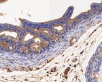 USP21 Antibody in Immunohistochemistry (Paraffin) (IHC (P))