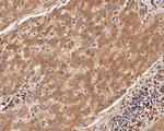 USP21 Antibody in Immunohistochemistry (Paraffin) (IHC (P))