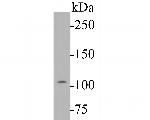 Dynamin 1 Antibody in Western Blot (WB)