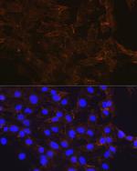 beta Catenin Antibody in Immunocytochemistry (ICC/IF)