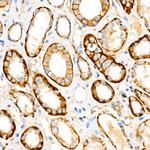 beta Catenin Antibody in Immunohistochemistry (Paraffin) (IHC (P))