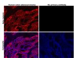 beta Catenin Antibody in Immunohistochemistry (Paraffin) (IHC (P))