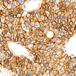 beta Catenin Antibody in Immunohistochemistry (Paraffin) (IHC (P))