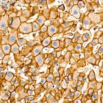 beta Catenin Antibody in Immunohistochemistry (Paraffin) (IHC (P))