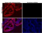 beta Catenin Antibody in Immunohistochemistry (Paraffin) (IHC (P))