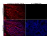 beta Catenin Antibody in Immunohistochemistry (Paraffin) (IHC (P))