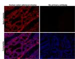 beta Catenin Antibody in Immunohistochemistry (Paraffin) (IHC (P))