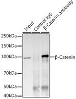 beta Catenin Antibody in Immunoprecipitation (IP)