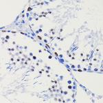 HDAC1 Antibody in Immunohistochemistry (Paraffin) (IHC (P))