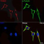 TOM20 Antibody in Immunocytochemistry (ICC/IF)