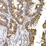 TOM20 Antibody in Immunohistochemistry (Paraffin) (IHC (P))