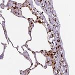 Annexin A1 Antibody in Immunohistochemistry (Paraffin) (IHC (P))