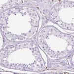 Annexin A1 Antibody in Immunohistochemistry (Paraffin) (IHC (P))