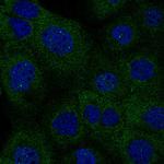 IDH1 Antibody in Immunocytochemistry (ICC/IF)