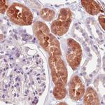 IDH1 Antibody in Immunohistochemistry (Paraffin) (IHC (P))