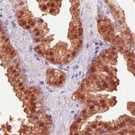 IDH1 Antibody in Immunohistochemistry (Paraffin) (IHC (P))