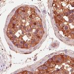 IDH1 Antibody in Immunohistochemistry (Paraffin) (IHC (P))