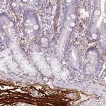 Fibrillin 1 Antibody in Immunohistochemistry (Paraffin) (IHC (P))