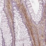 Fibrillin 1 Antibody in Immunohistochemistry (Paraffin) (IHC (P))