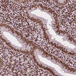 CTCF Antibody in Immunohistochemistry (Paraffin) (IHC (P))