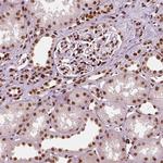 CTCF Antibody in Immunohistochemistry (Paraffin) (IHC (P))