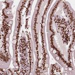 CTCF Antibody in Immunohistochemistry (Paraffin) (IHC (P))