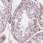 CTCF Antibody in Immunohistochemistry (Paraffin) (IHC (P))