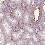 VEGF Receptor 1 Antibody in Immunohistochemistry (Paraffin) (IHC (P))