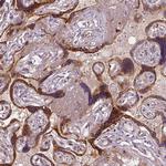 VEGF Receptor 1 Antibody in Immunohistochemistry (Paraffin) (IHC (P))