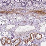 VEGF Receptor 1 Antibody in Immunohistochemistry (Paraffin) (IHC (P))