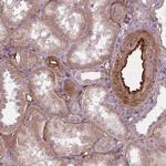 VEGF Receptor 1 Antibody in Immunohistochemistry (Paraffin) (IHC (P))