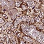 VEGF Receptor 1 Antibody in Immunohistochemistry (Paraffin) (IHC (P))