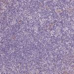 VEGF Receptor 1 Antibody in Immunohistochemistry (Paraffin) (IHC (P))