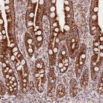 SDHB Antibody in Immunohistochemistry (Paraffin) (IHC (P))