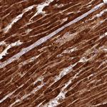 SDHB Antibody in Immunohistochemistry (Paraffin) (IHC (P))