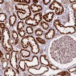 SDHB Antibody in Immunohistochemistry (Paraffin) (IHC (P))