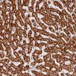 SDHB Antibody in Immunohistochemistry (Paraffin) (IHC (P))