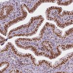 HDAC1 Antibody in Immunohistochemistry (Paraffin) (IHC (P))