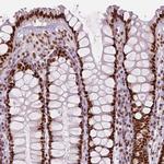 HDAC1 Antibody in Immunohistochemistry (Paraffin) (IHC (P))